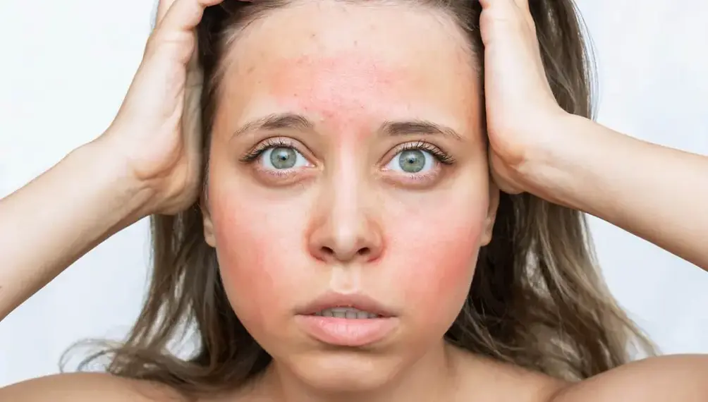 alergija kosmetikos priemonėms